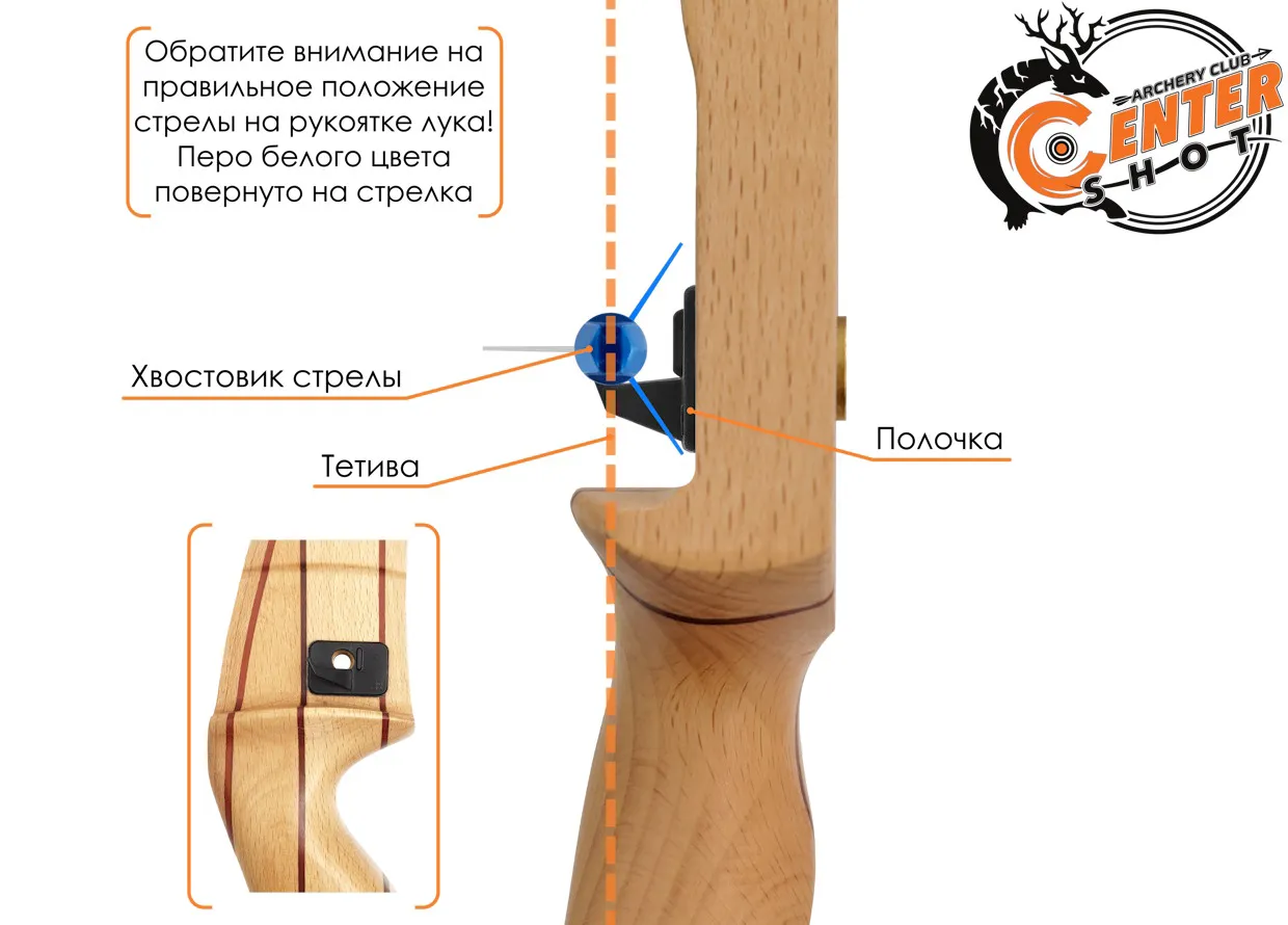 Синдром карпального канала